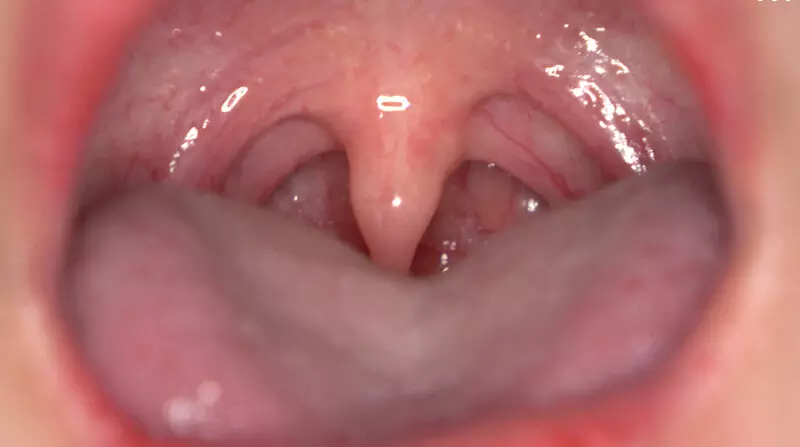 「h_1416ad02007 「【歯・口腔フェチ】新人女優相楽さゆなちゃんの口内観察＆巨大女フェチ」わかしラボWAKA-078 相楽さゆな 9」のサムネイル画像