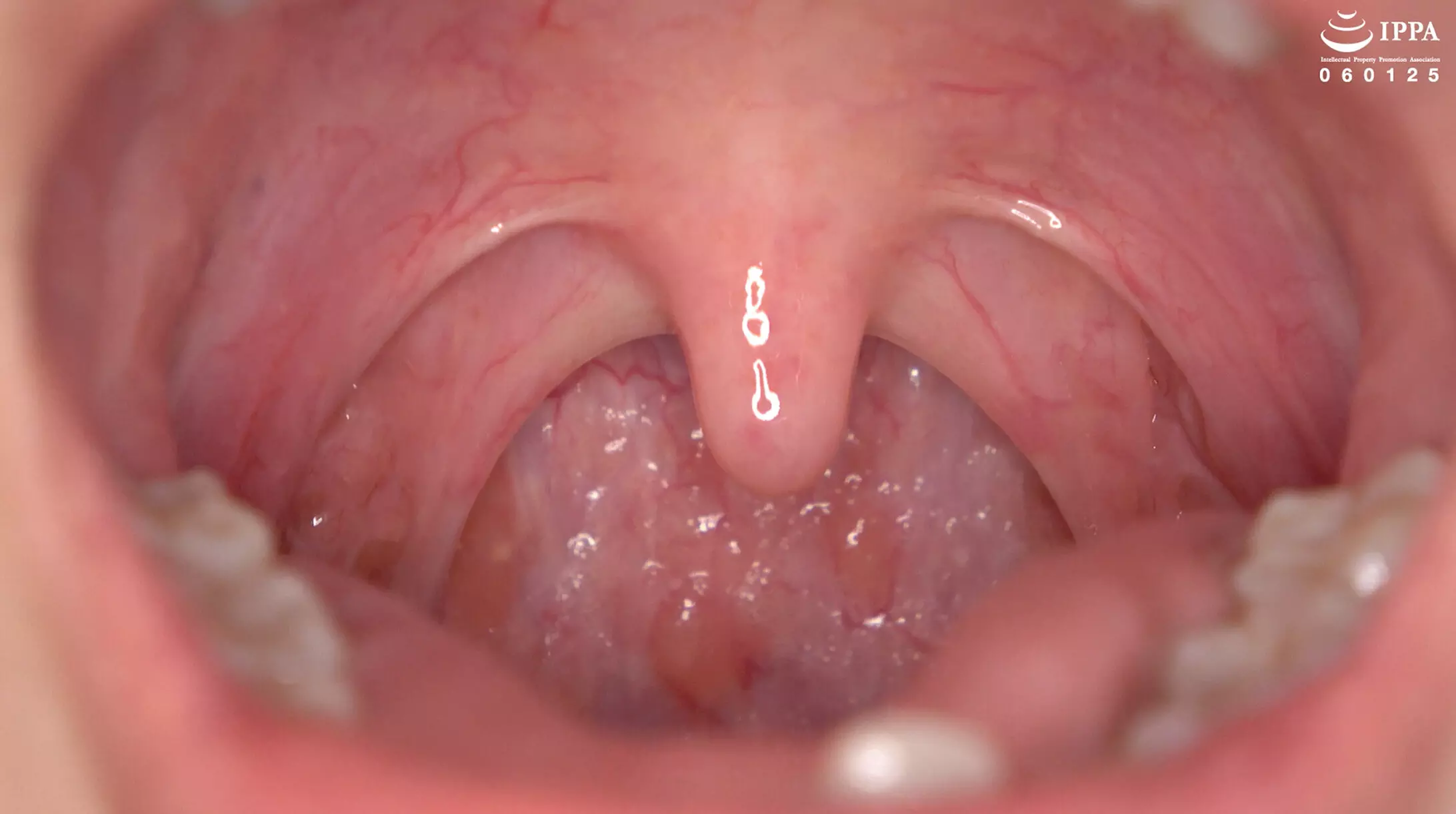 「h_1416ad02042 「【歯・口腔フェチ】くすぐったがりの谷田かりなちゃんの口内観察！＆巨大女フェチ」谷田かりな」のサムネイル画像