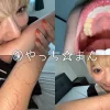 「h_1651y00297 【個人撮影】安堂はるの 歯並び綺麗な強め噛みつき」のサムネイル画像